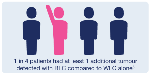 BLC vs WLC